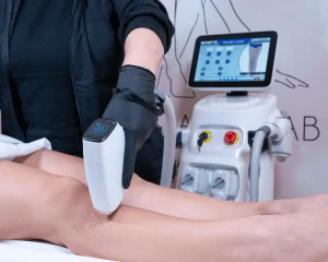 Μία γυναίκα κάνει αποτρίχωση laser στα πόδια